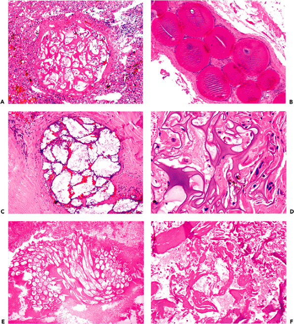 8 Skeletal Muscle Histology for Pathologists